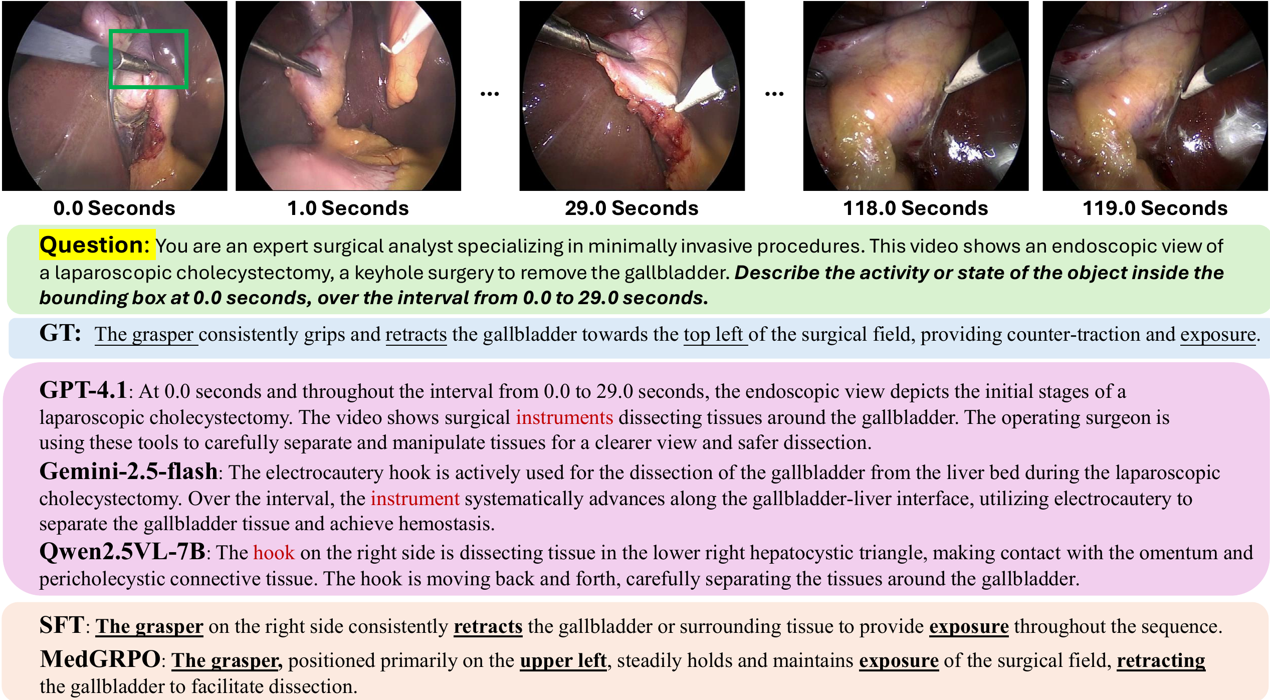 Qualitative comparison of region captioning
